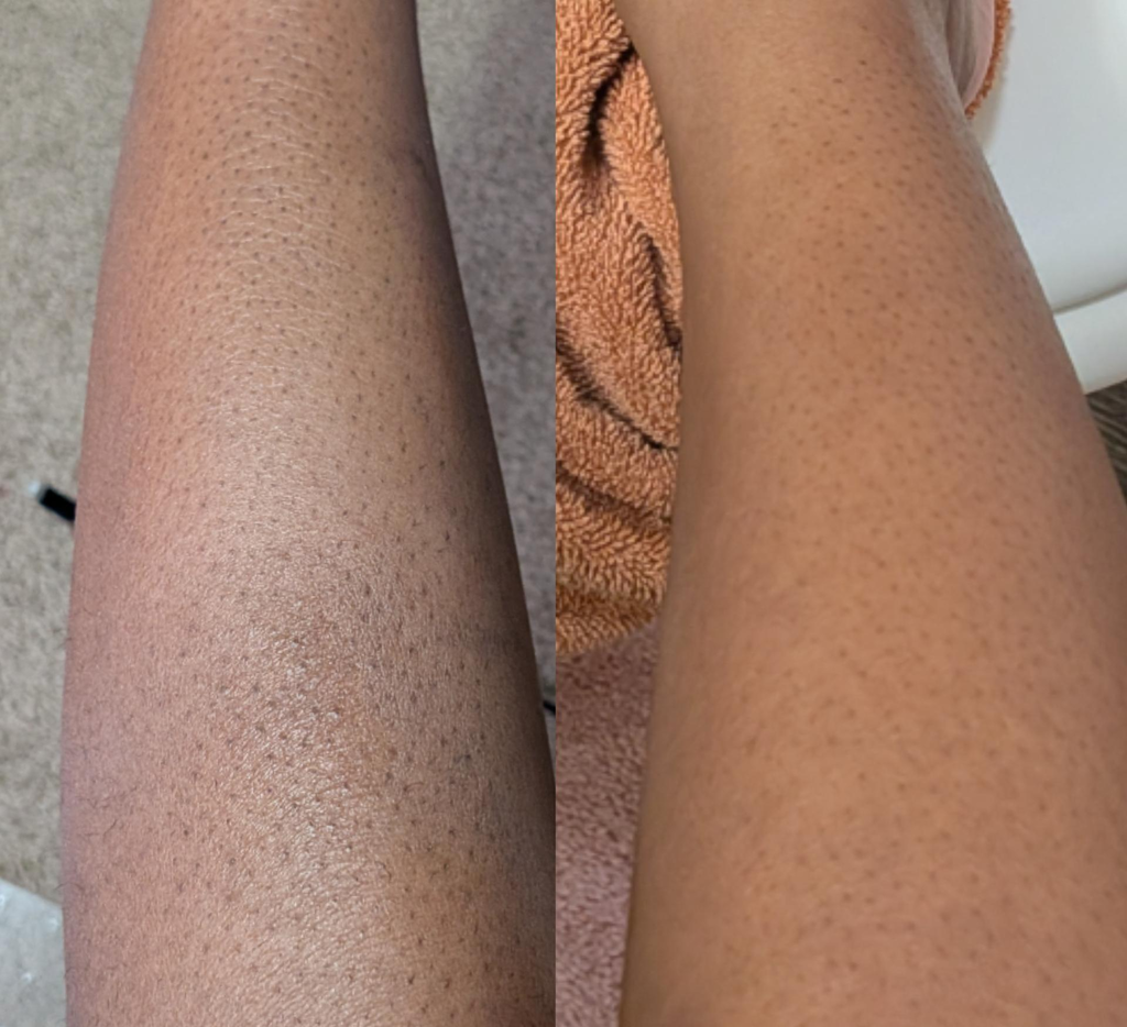 Customer review photo
