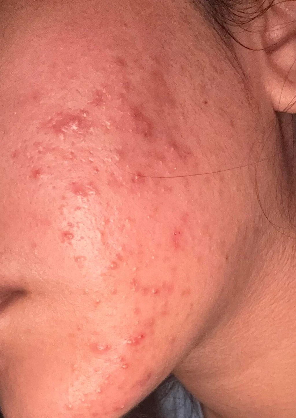 Customer review photo from Mehak