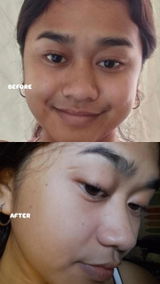Anonymous review photo