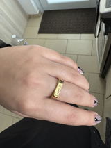 Anonymous review photo