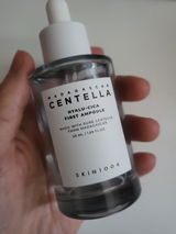 Anonymous review photo