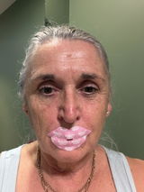Anonymous review photo
