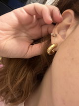 Anonyme review photo