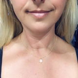 Dolly review photo