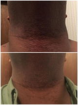 Customer review photo
