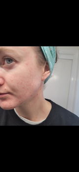 Emily D. review photo