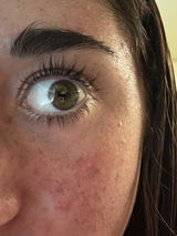 Anonymous review photo