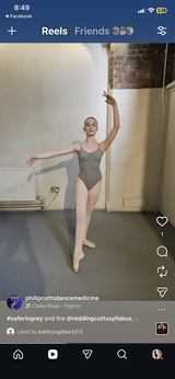 Anonymous review photo