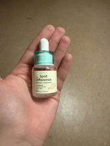 Anonym review photo