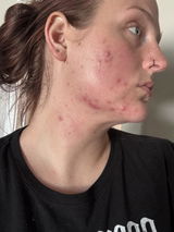 Brandi Milsted review photo