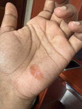 Anonymous review photo