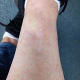 Denise Thorby review photo
