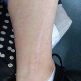 Denise Thorby review photo