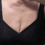 Lura review photo