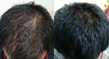 Marek review photo