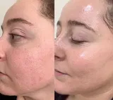 kerri staggers review photo