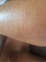 Anonymní review photo