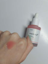 Neto review photo