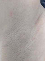 Clothdrug review photo