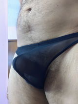 Anonymous review photo