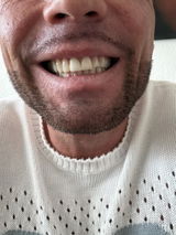 Imre review photo