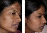 Minakshi Mohite review photo