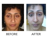 Meera Choudhary review photo