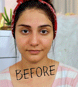 Neha Patel review photo