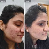 Harshita Negi review photo