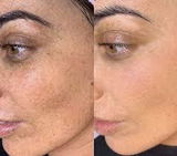 Nikki Jain review photo