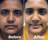 Aditi KumarI review photo