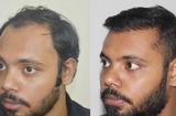 Vasant Chandra review photo
