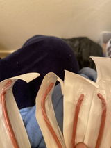 Anonymous review photo