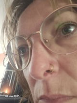 Anonymous review photo
