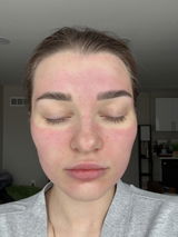Anonymous review photo