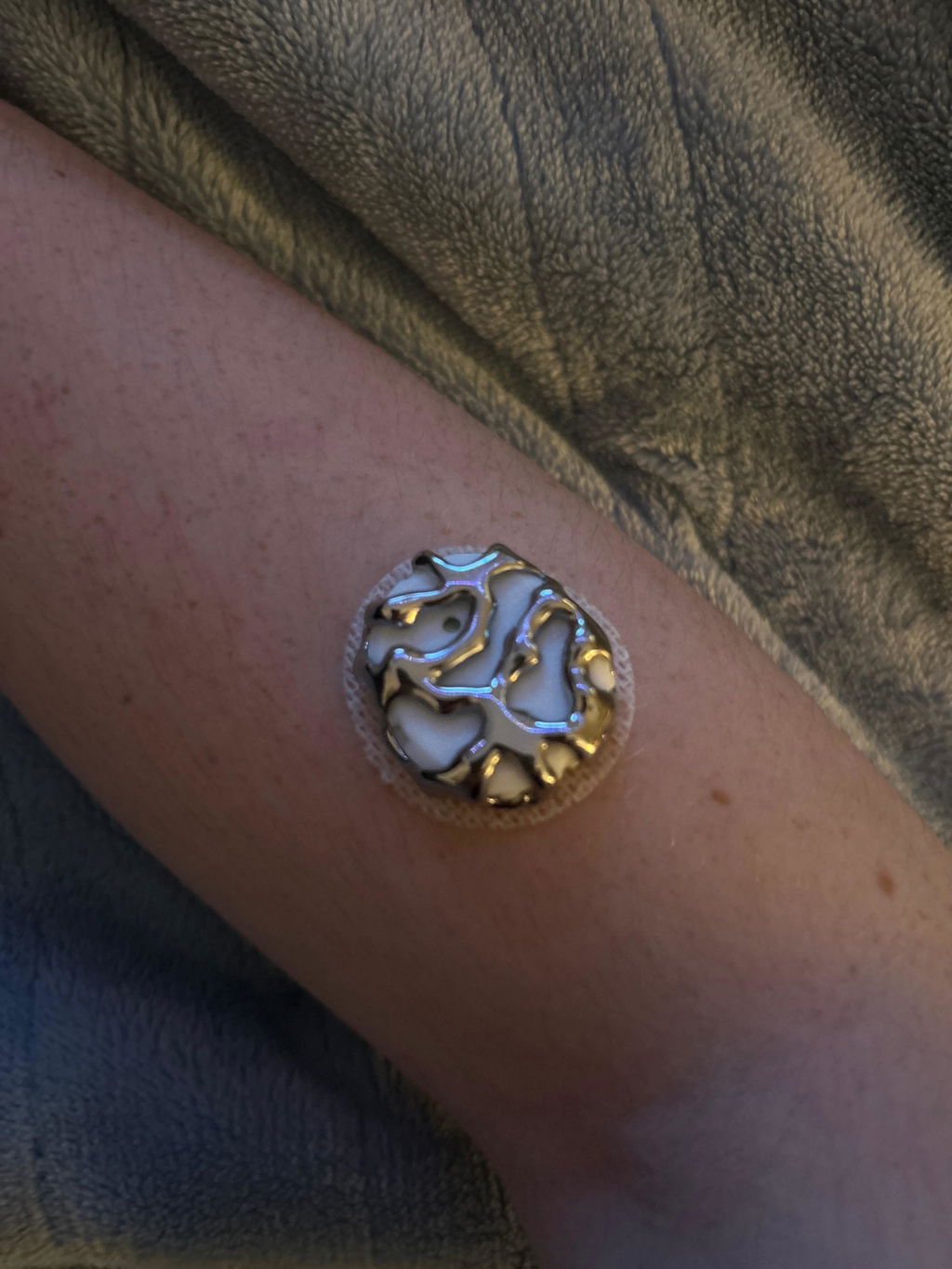 Venom — Dexcom G7 / One+