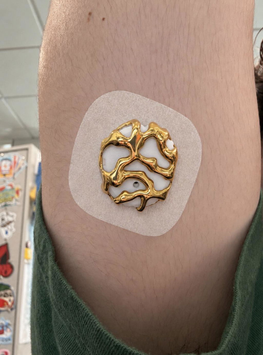Venom — Dexcom G7 / One+