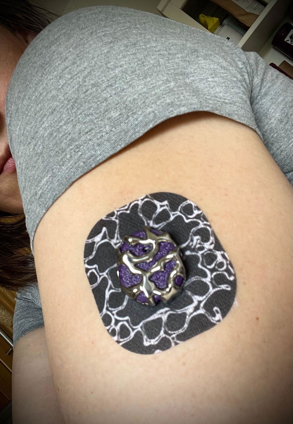 Venom — Dexcom G7 / One+