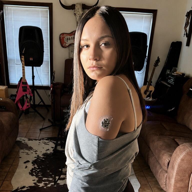 Venom — Dexcom G7 / One+