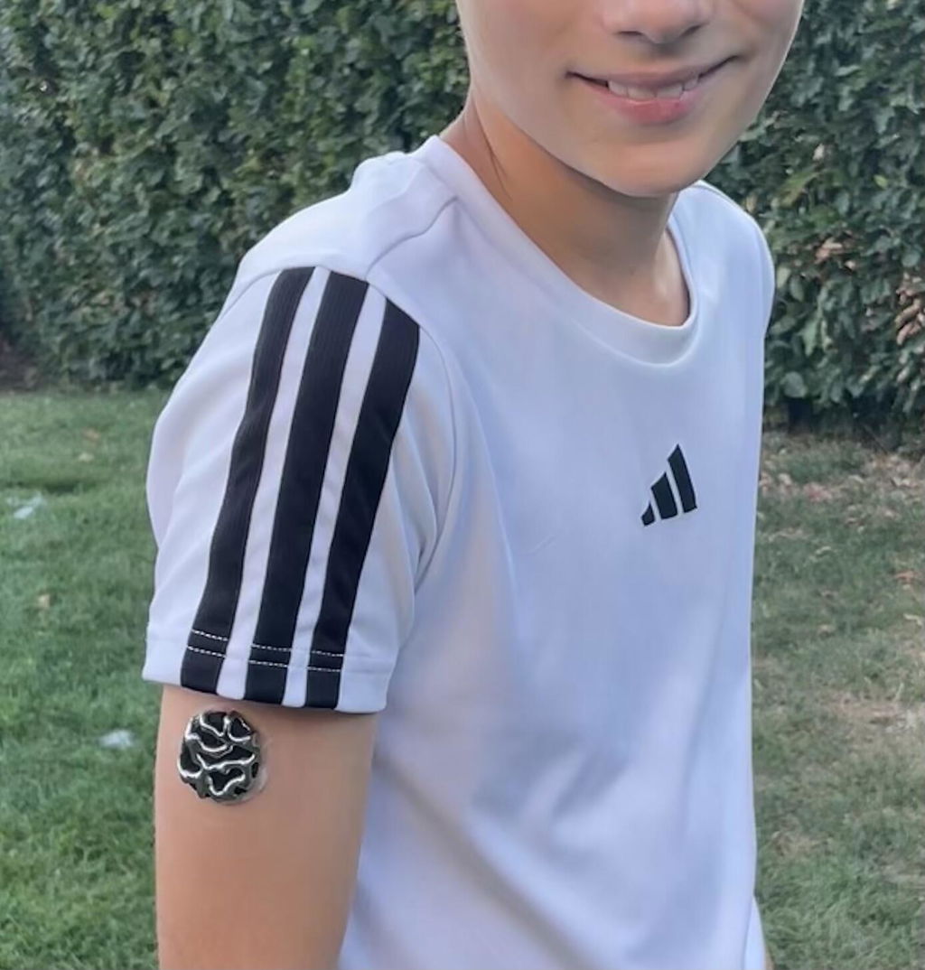 Venom — Dexcom G7 / One+