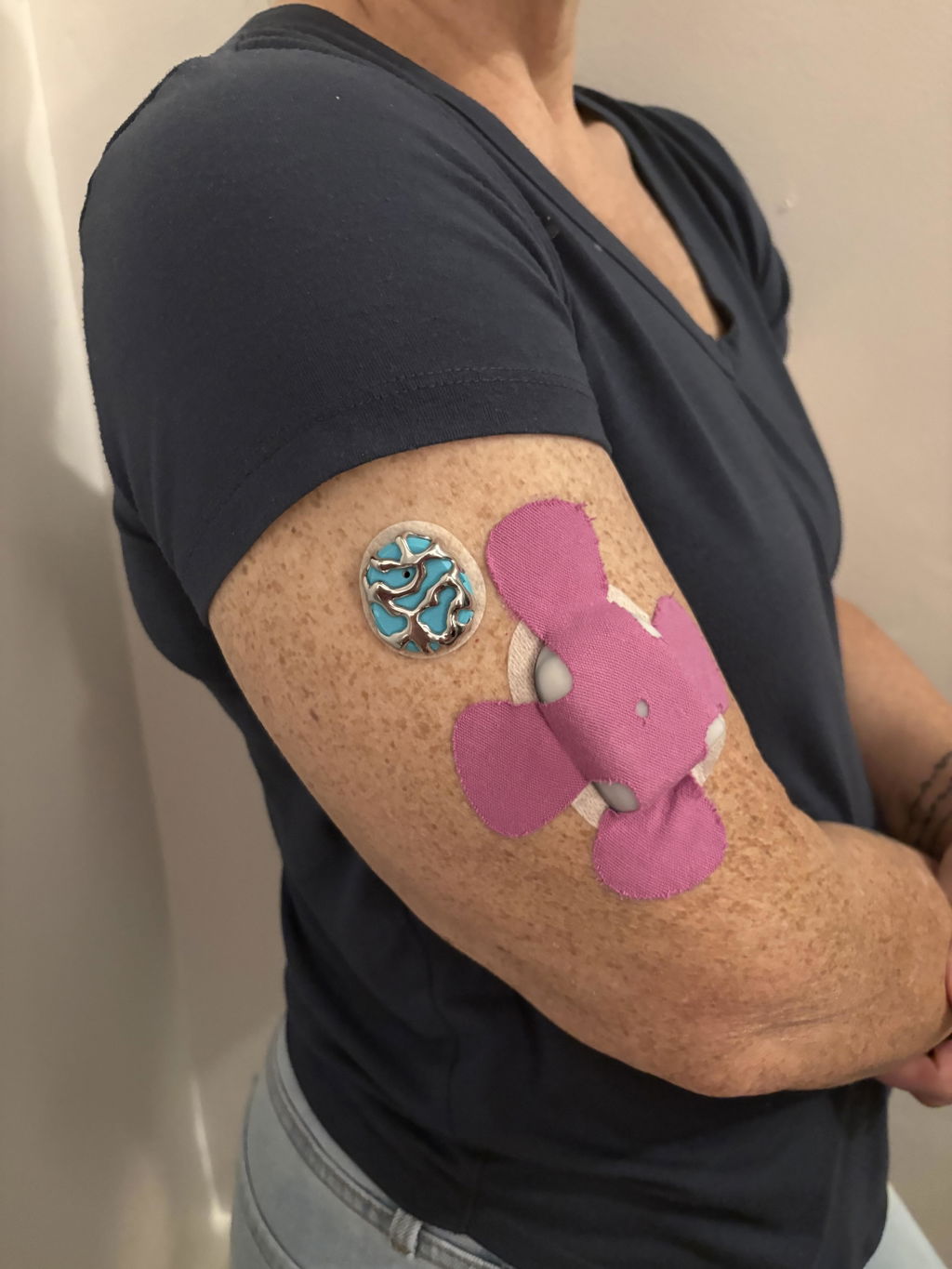 Venom — Dexcom G7 / One+