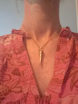 Anonym review photo