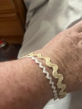 Anonyme review photo