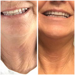 Customer result photo 12