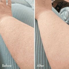 Customer result photo 8