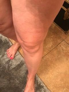Customer result photo 11