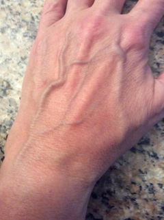 Customer result photo 7