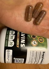 Anonymous review photo