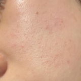 L review photo