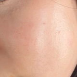 L review photo